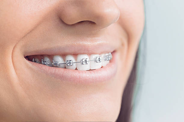 Best Veneers and Lumineers  in Gonzales, LA